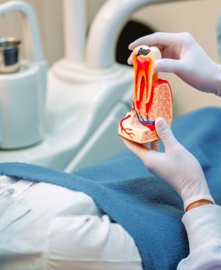 Endodoncia